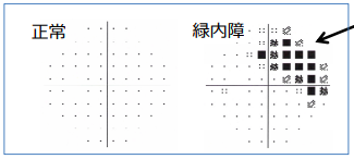 視神経繊維