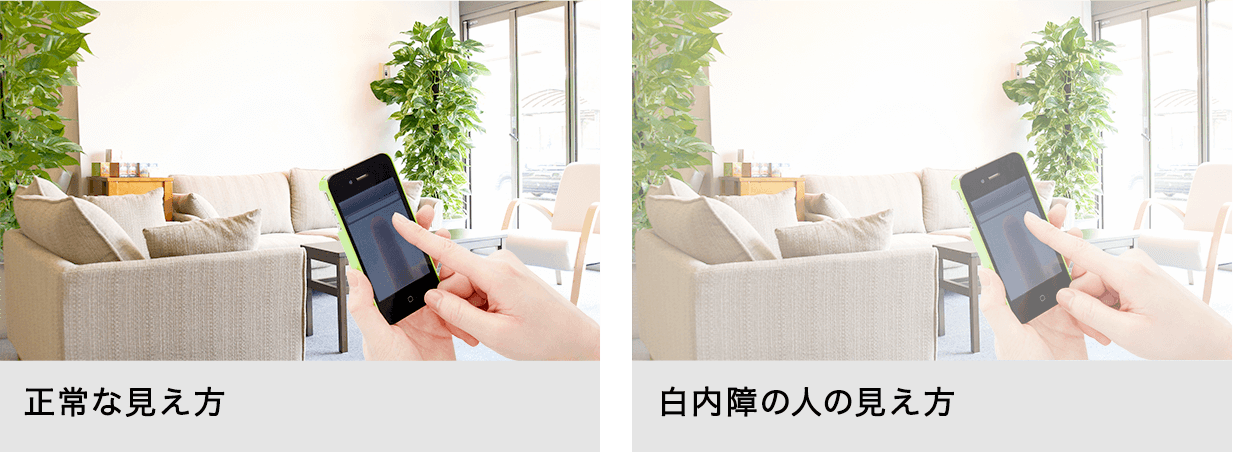 白内障