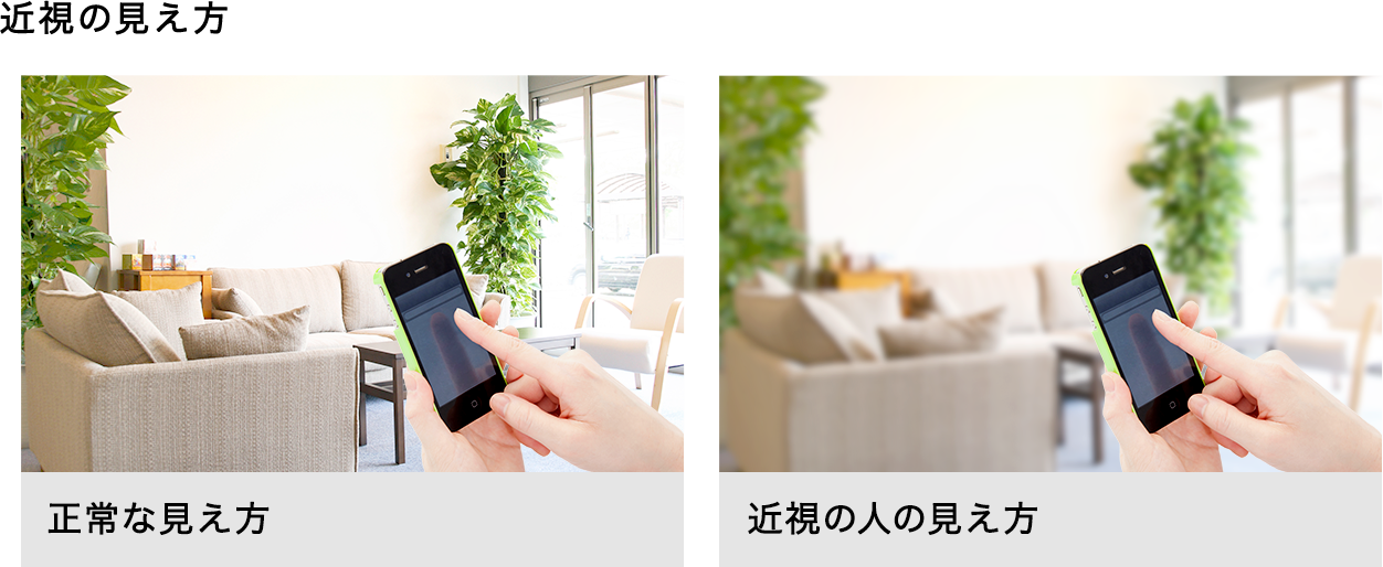 近視